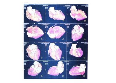 High Sharpness Xray Paper Films , Agfa Dt2b Fuji Medical Thermal Films