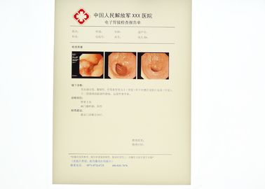 Scratch-resistant X-ray Paper Medical Film For KND-DRYTEC-3000, KND-DRYTEC-4000
