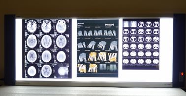 Good price 10in * 14in Digital x-ray Dry Medical Imaging Films For Thermal Printers KND-F online