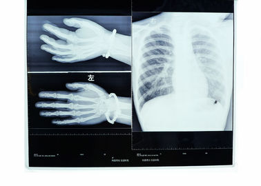 Good price Konida Medical Dry Film High Resolution Heat Resisting Imaging online