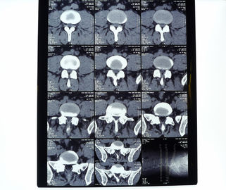 Good price White PET AGFA Medical Dry Film online