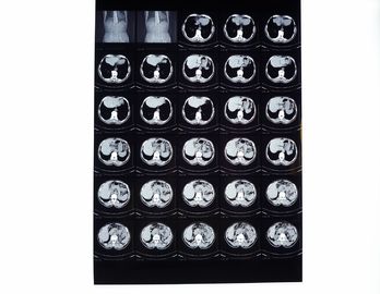 Medical X ray Films, Dry Imaging Film Compatible With Thermal Printer For CT / DR / MRI