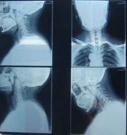 Good price KND-K Scratch-resistant Medical Paper Dry Imaging Film For Radiographic Examination online
