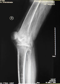 Good price KND-A Low Fog Medical Dry Imaging Film For X Ray Examination On AGFA 5300, 5302, 5500 online
