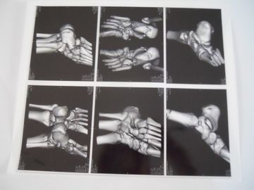 Good price Medical Dry Imaging Film For X Ray Examination On AGFA 5300, 5302, 5500 online