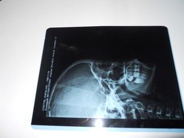 Good price KND-A Environment friendly Medical Dry Imaging Film For X Ray Examination On AGFA 5300 online