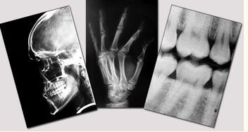 Good price Blue Medical Dry Imaging Film , 11in x 14in Laser Fuji X Ray Film online