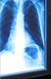 Good price Blue X-ray Dry Medical Imaging Film 11in x 17in For Thermal Printer online
